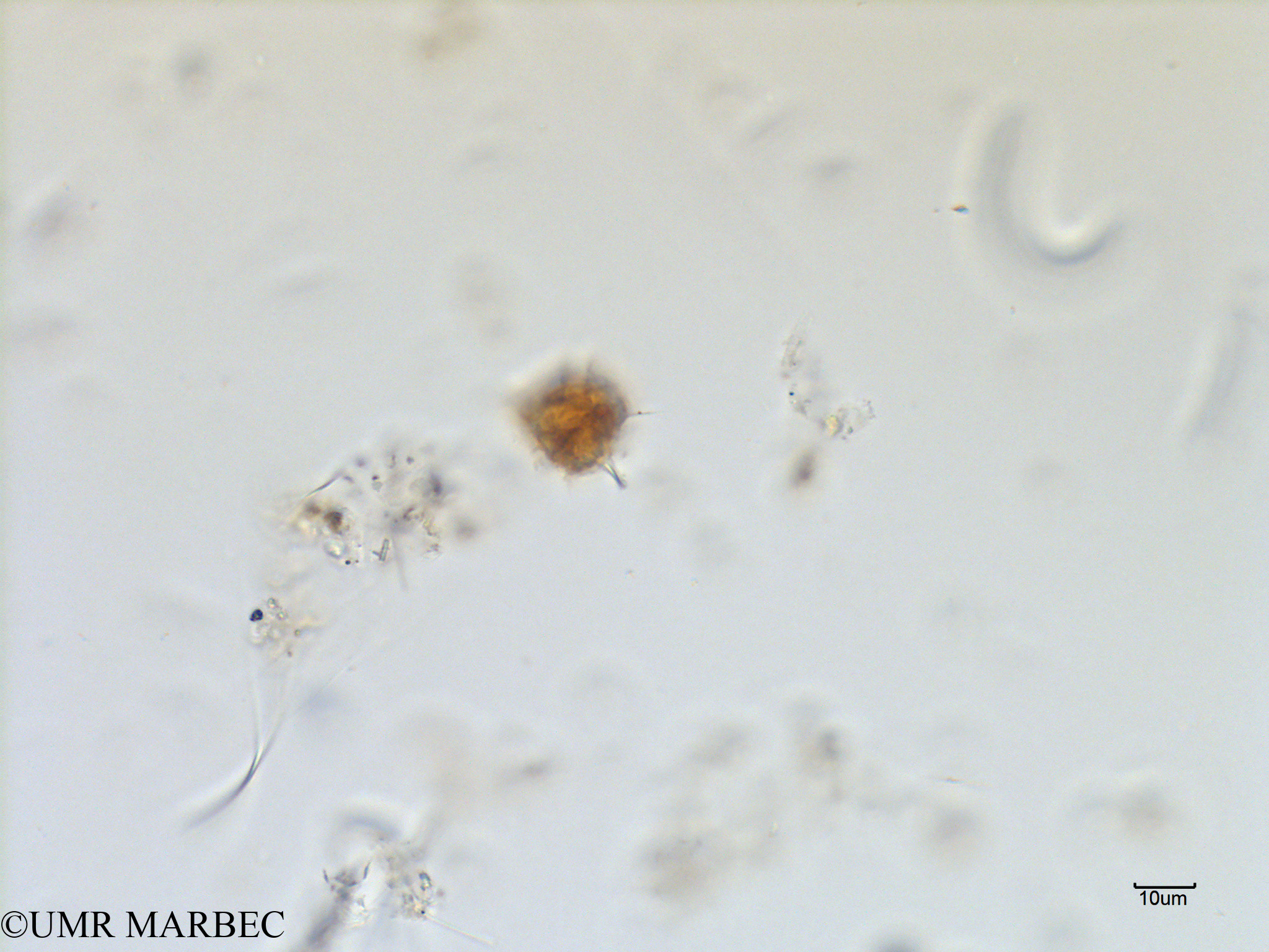 phyto/Scattered_Islands/mayotte_lagoon/SIREME May 2016/Protoperidinium bipes (old P. sp53 -MAY7_Protoperidinium2 bdd-3).tif(copy).jpg